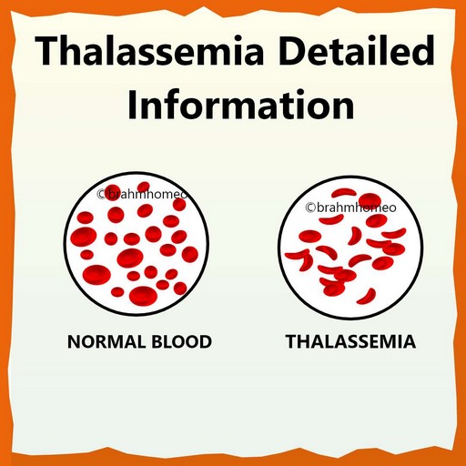 Apa Itu Thalasemia